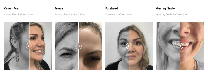 before and after slider on the cosmetological website