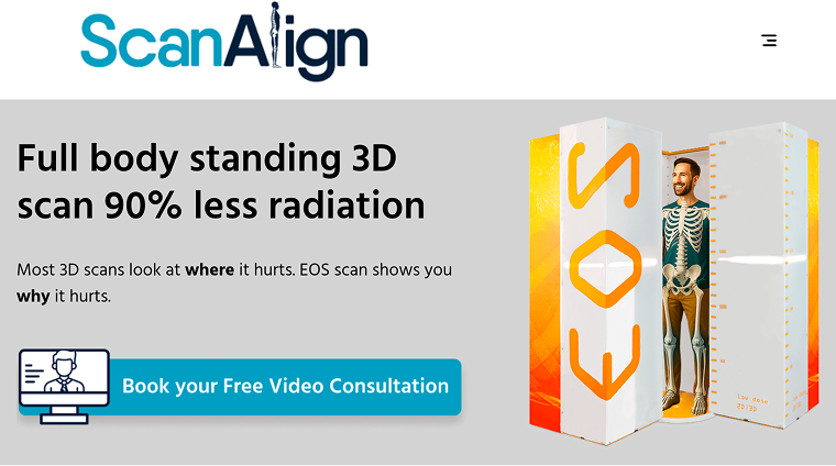 scanalign example